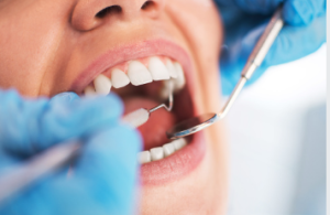 dentist West Lakes