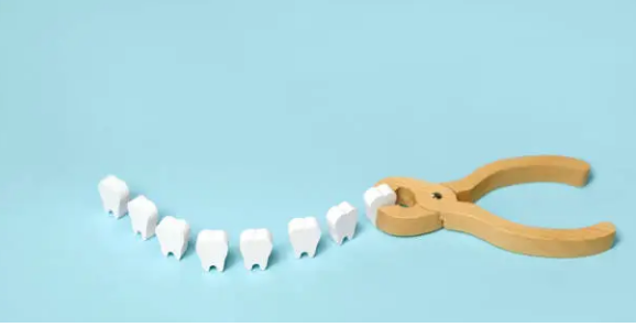 Wisdom Teeth Removal Adelaide’ Same-Day Pain & Swelling Relief in Marion and Southern Adelaide wisdom teeth removal Adelaide